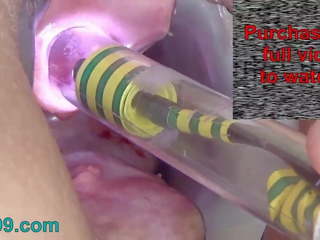 Endoscope kamera ke dalam peehole wanita pee lubang bermain.